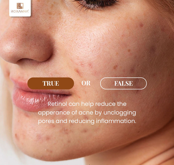 Roxanna Retinol Night Face Cream – Anti-Ageing Moisturiser for Wrinkles, Fine Lines & Uneven Skin Tone (50ml)
