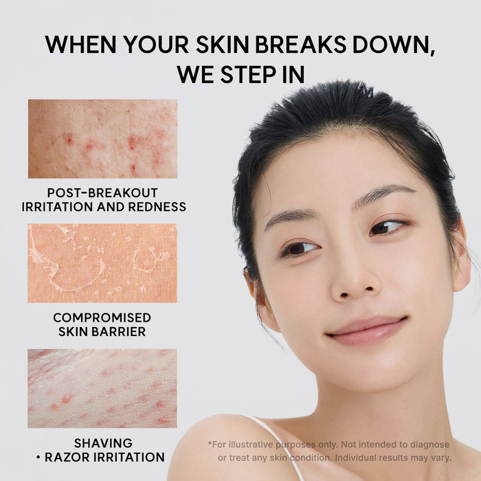 ARENCIA Eraser Soothing Cream - DOKAN