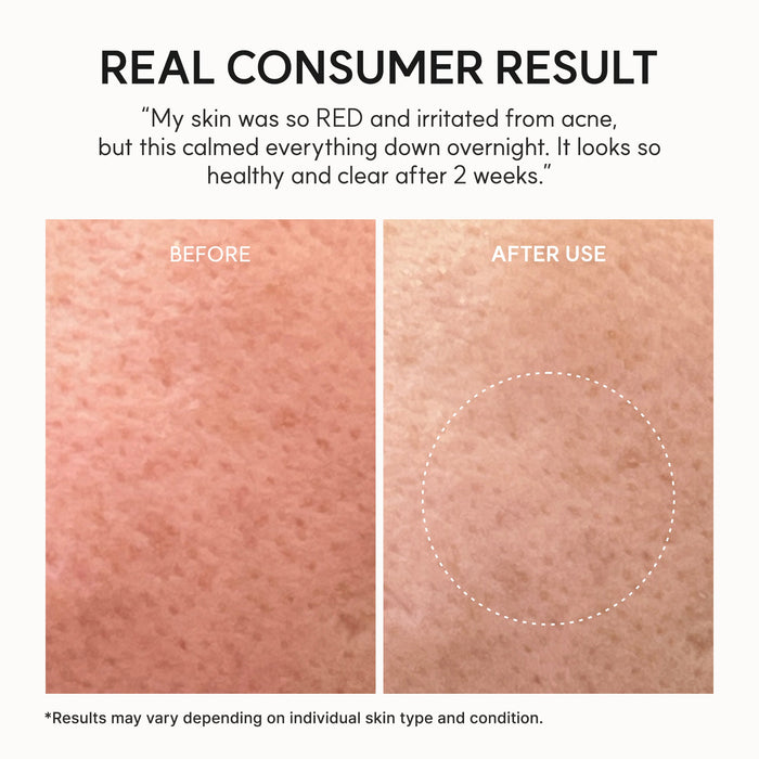 ARENCIA Eraser Soothing Cream - DOKAN