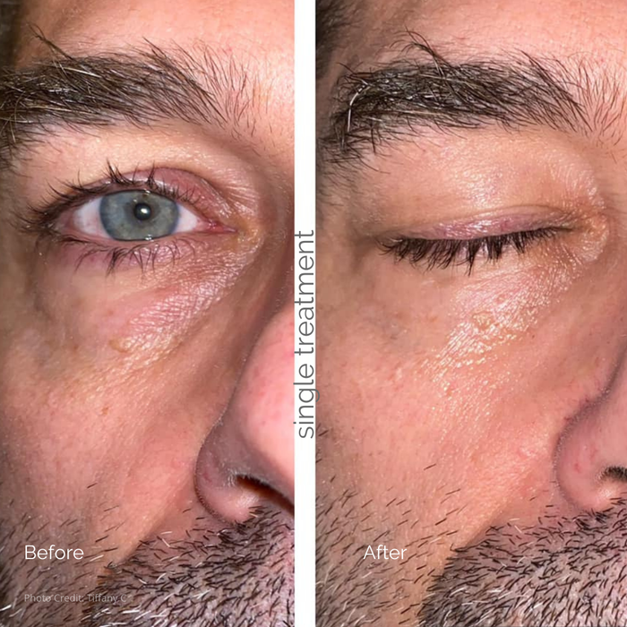 DISCONTINUED - Eye Rejuvenation | MBK Skincare