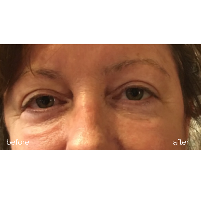 DISCONTINUED - Eye Rejuvenation | MBK Skincare