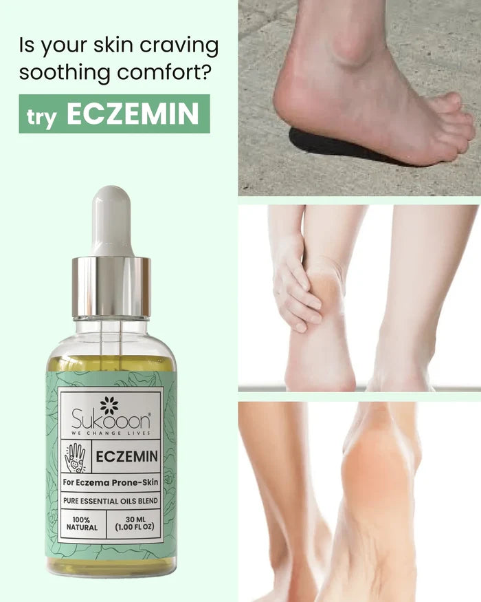 Eczemin Essential Oil 30ml