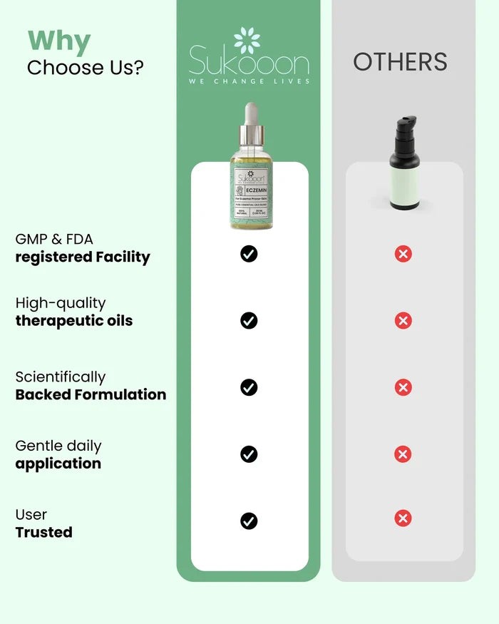 Eczemin Essential Oil 30ml
