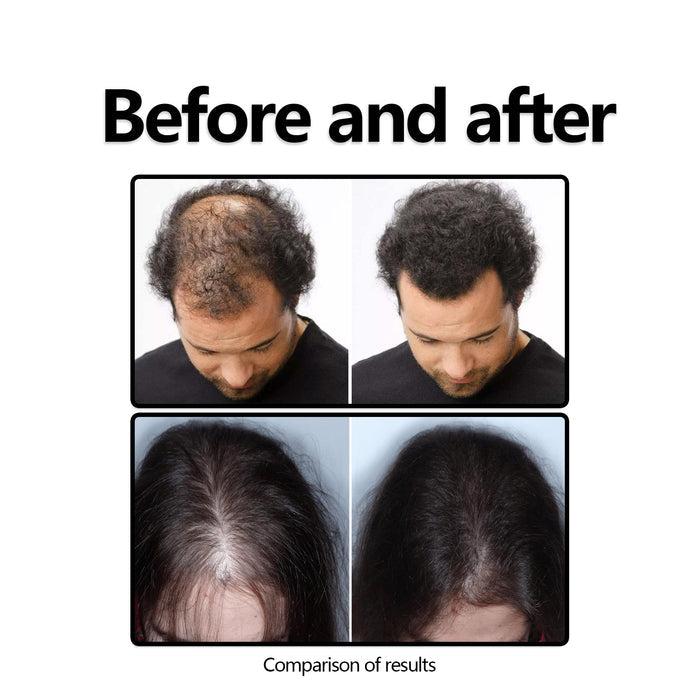 EELHOE Boost Hair Serum – Anti-Hair Loss & Strengthening Treatment EELHOE COSMETICS