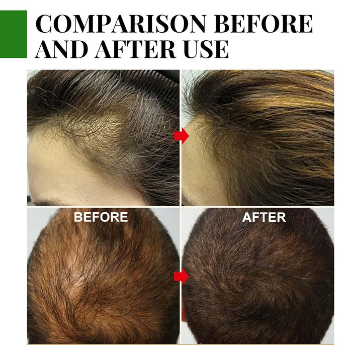 EELHOE Rosemary Hair Care Capsules – Nourish Hair Roots & Help Prevent Hair Loss EELHOE COSMETICS