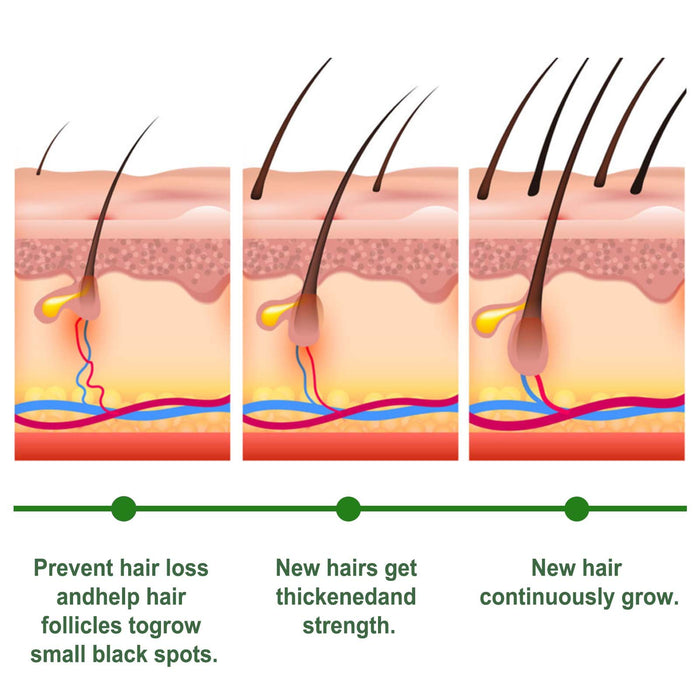 EELHOE Rosemary Hair Care Capsules – Nourish Hair Roots & Help Prevent Hair Loss EELHOE COSMETICS
