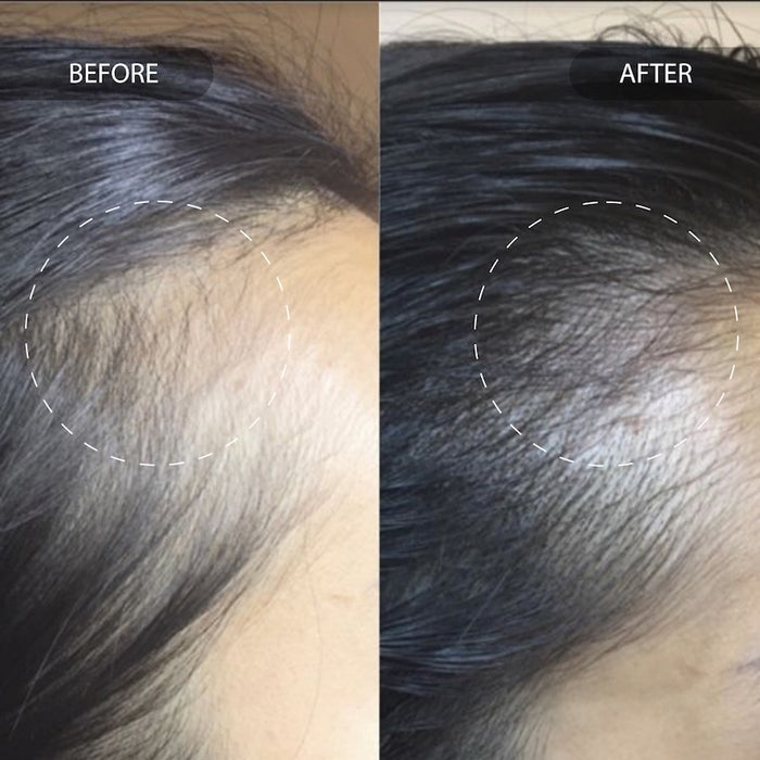 Before and after magic drip has been used to give black hair visible thickness and promotes new hair growth
