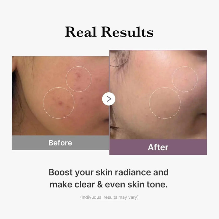 MEDICUBE Age-R Glutathione Glow Toner 140 ML - DOKAN