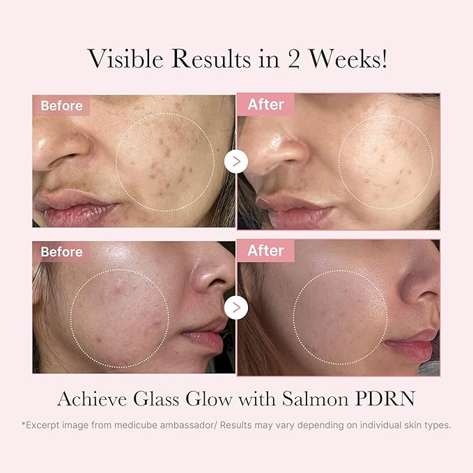 MEDICUBE PDRN Glow Kit - DOKAN